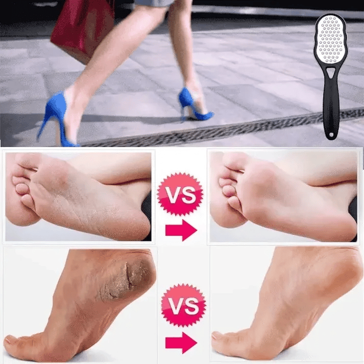 ✨Stainless Steel Exfoliating Foot File