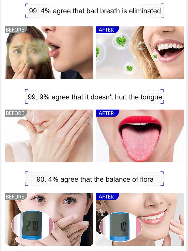 Fresh Breath and Tongue Cleansing Gel