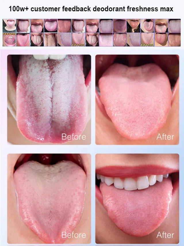 Fresh Breath and Tongue Cleansing Gel